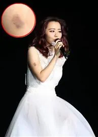 舞台成明星事故高发地：张靓颖摔伤 黄家驹坠亡